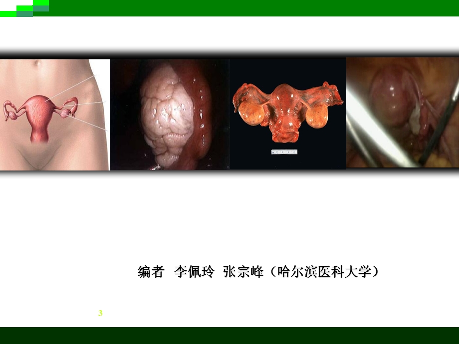 女性生殖系统解剖 妇产科学(本科)课件.ppt_第3页