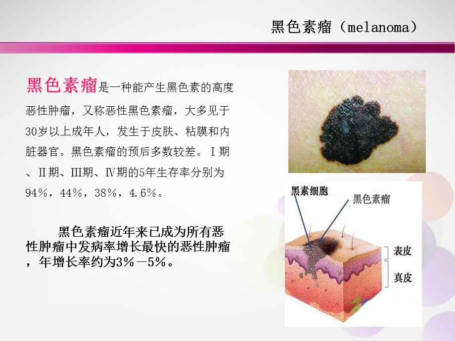 黑色素瘤整理版课件.ppt_第3页