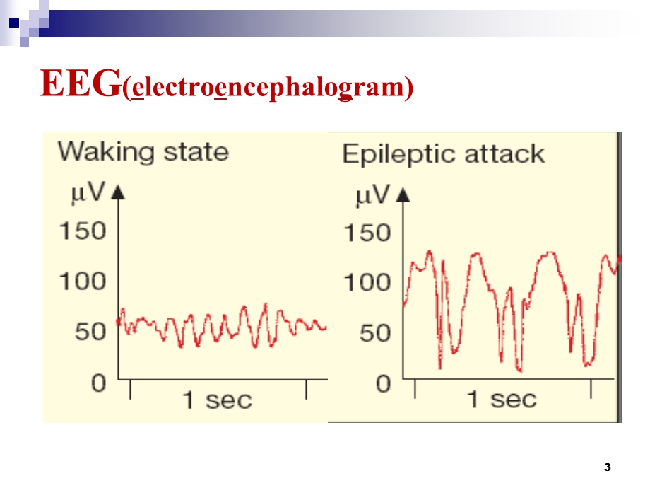 药理学抗癫痫药课件.ppt_第3页