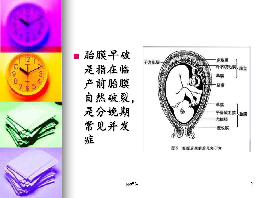 胎膜早破课件.ppt_第2页