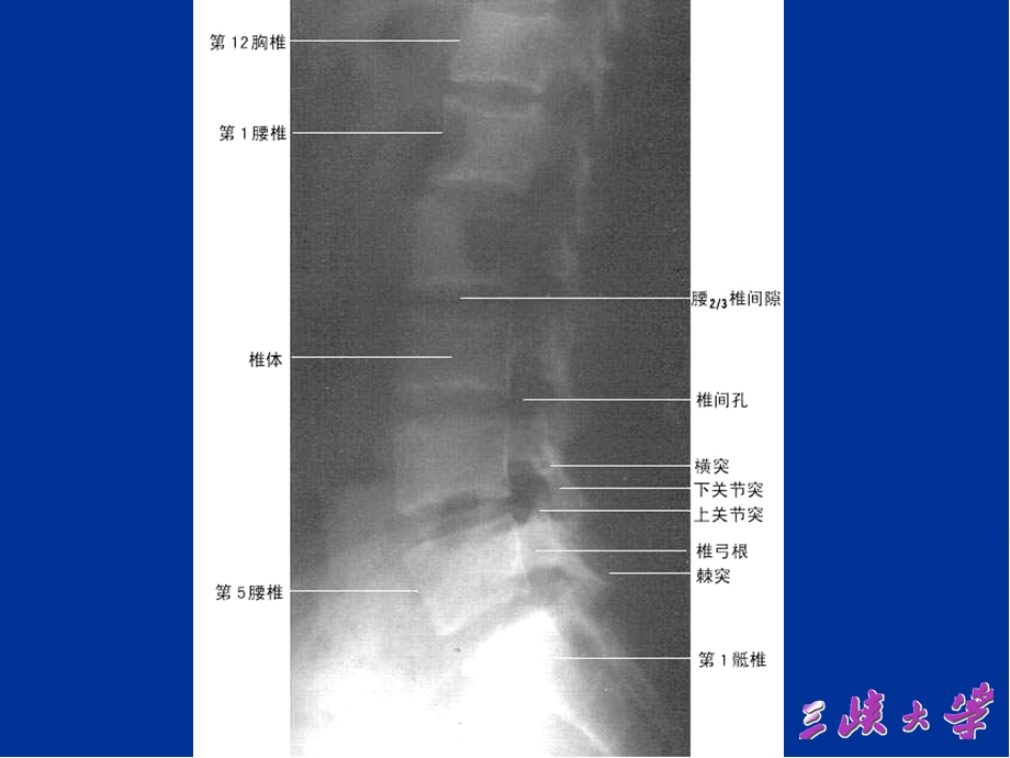 新腰椎影像解剖学精品课件.pptx_第2页