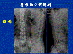 新腰椎影像解剖学精品课件.pptx