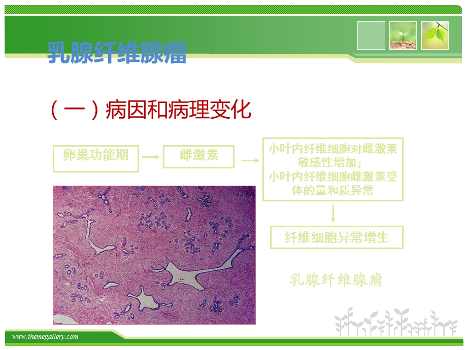 常见乳腺肿瘤的影像表现课件.pptx_第3页