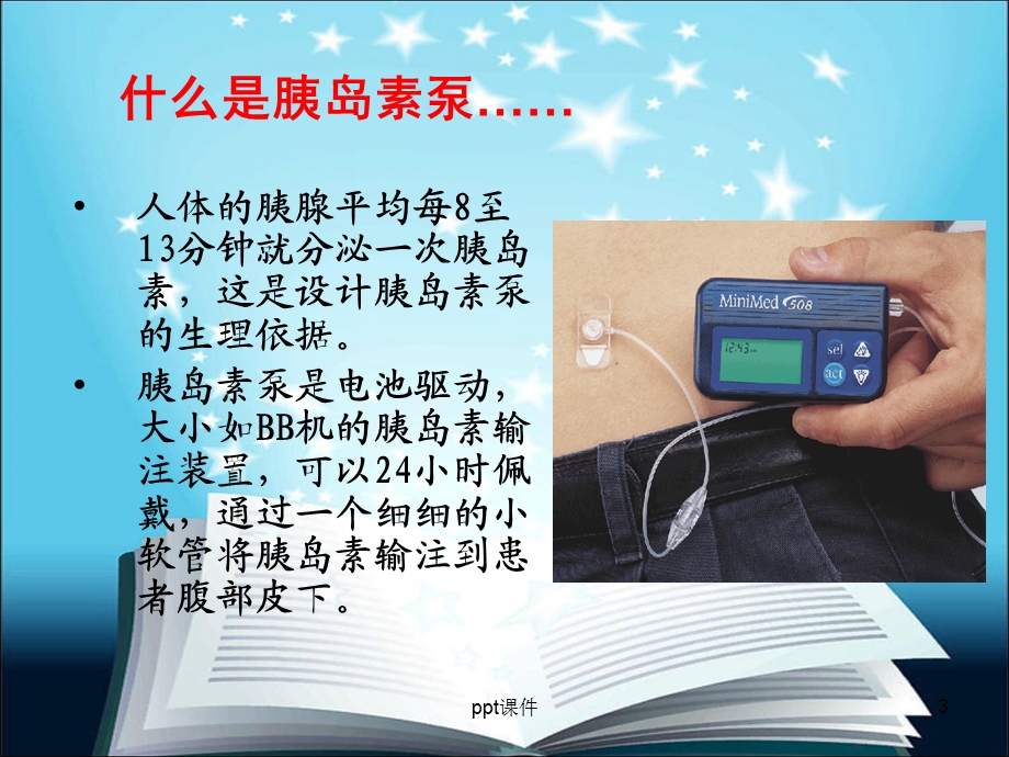 胰岛素泵的使用及护理课件.ppt_第3页