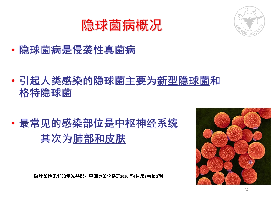 隐球菌病的诊断与治疗课件.ppt_第2页