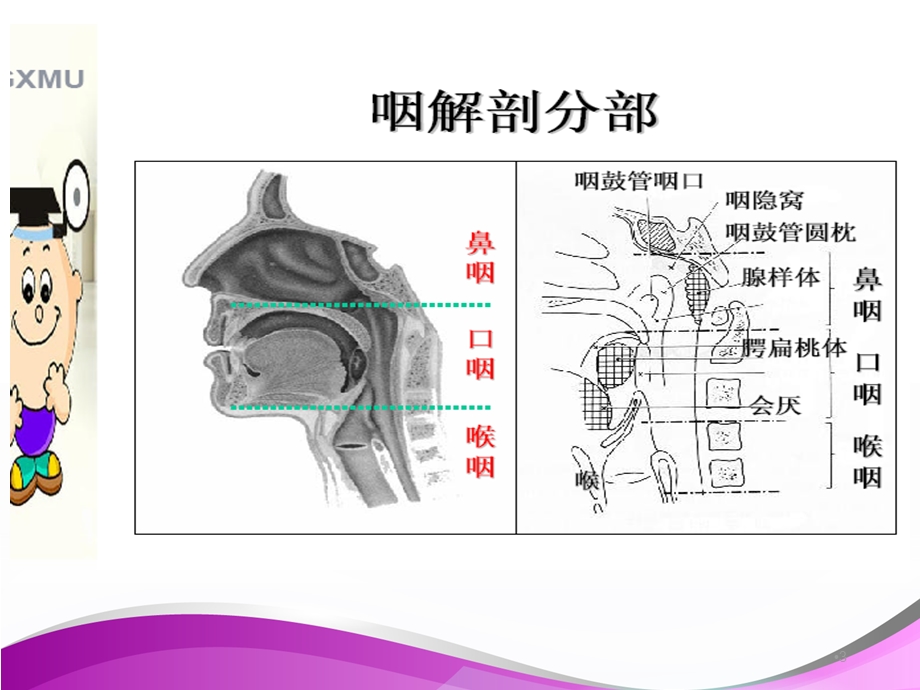 腺样体伴扁桃体肥大课件.ppt_第3页