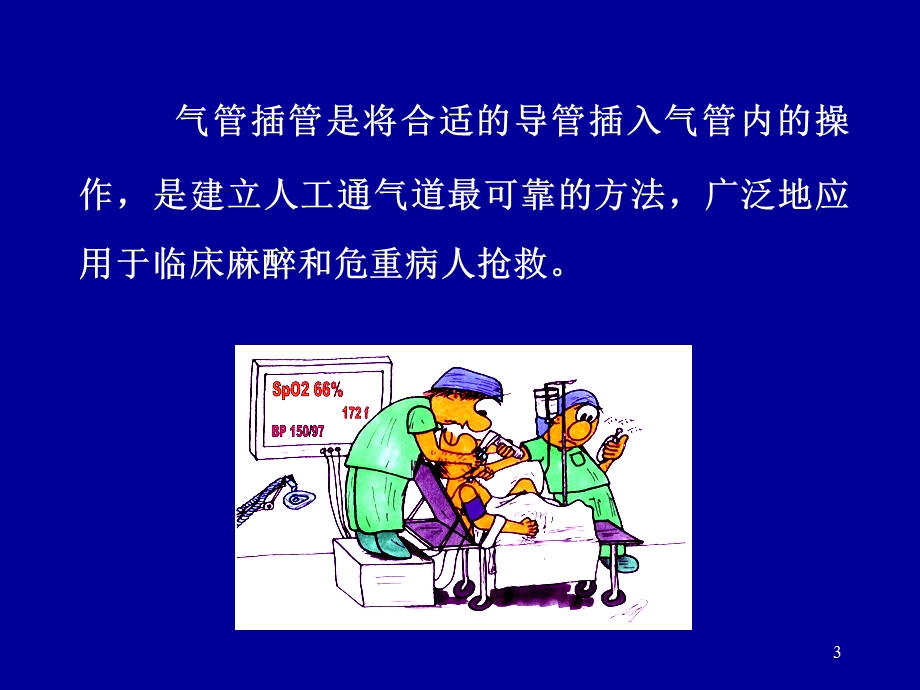 气管内插管术 课件.ppt_第3页