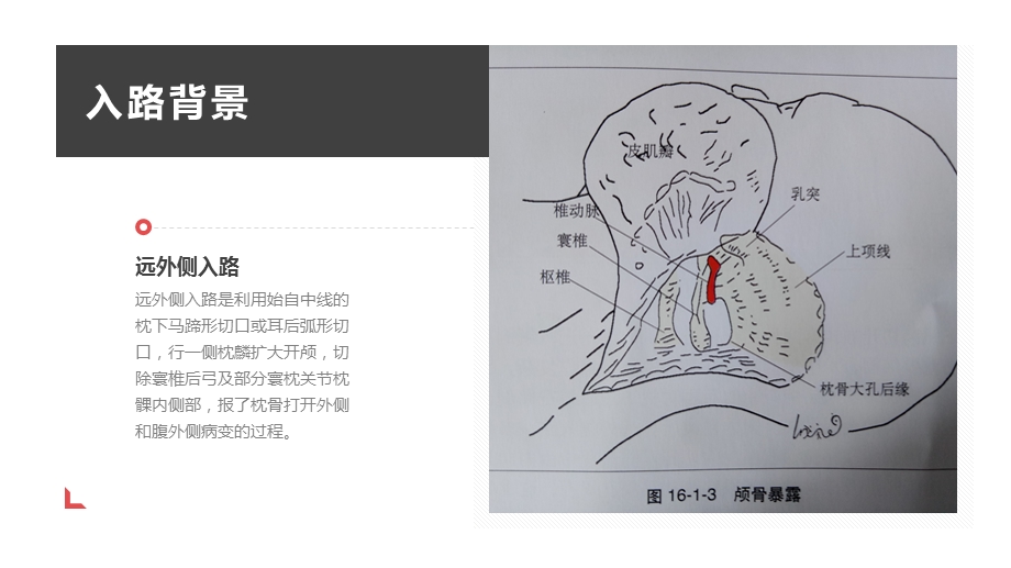 远外侧入路课件.ppt_第3页