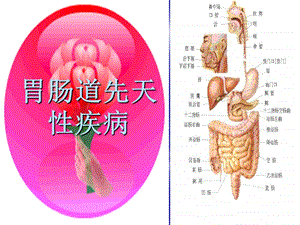 胃肠道先天性疾病课件.ppt