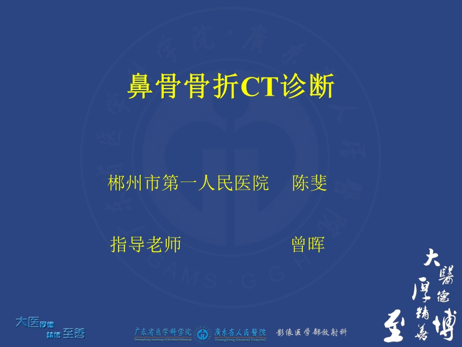 鼻骨骨折CT诊断课件.ppt_第1页