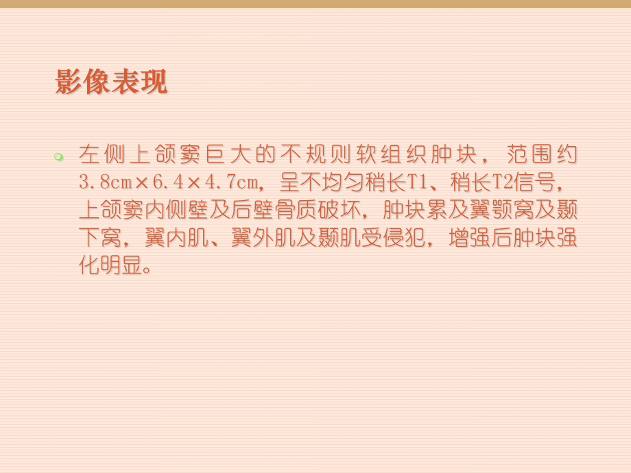 鼻腔及鼻窦恶性黑色素瘤课件.ppt_第3页