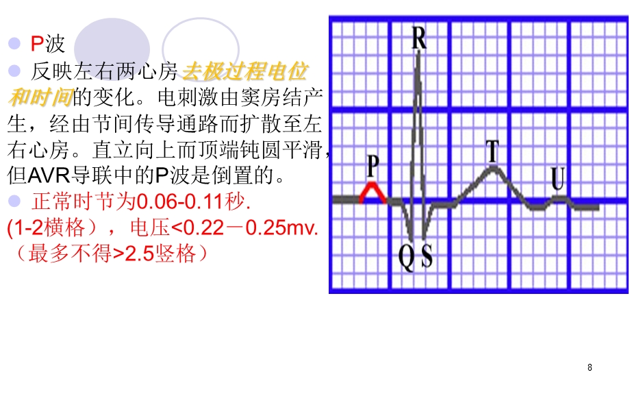 心肌梗死治疗及护理课件.ppt_第3页