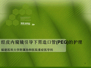 经皮内窥镜引导下胃造口管(PEG)的护理PPT课件.ppt