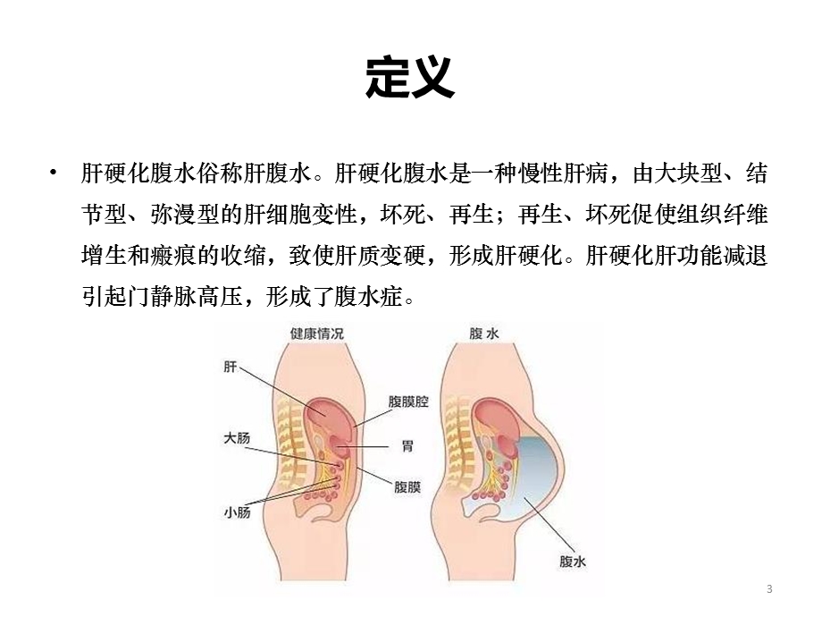 肝硬化腹水课件.ppt_第3页