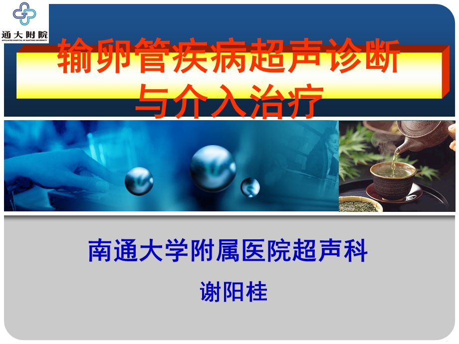 输卵管疾病超声诊断与介入治疗课件.ppt_第3页