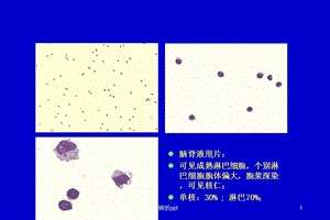 化脓性脑膜脑炎课件.ppt