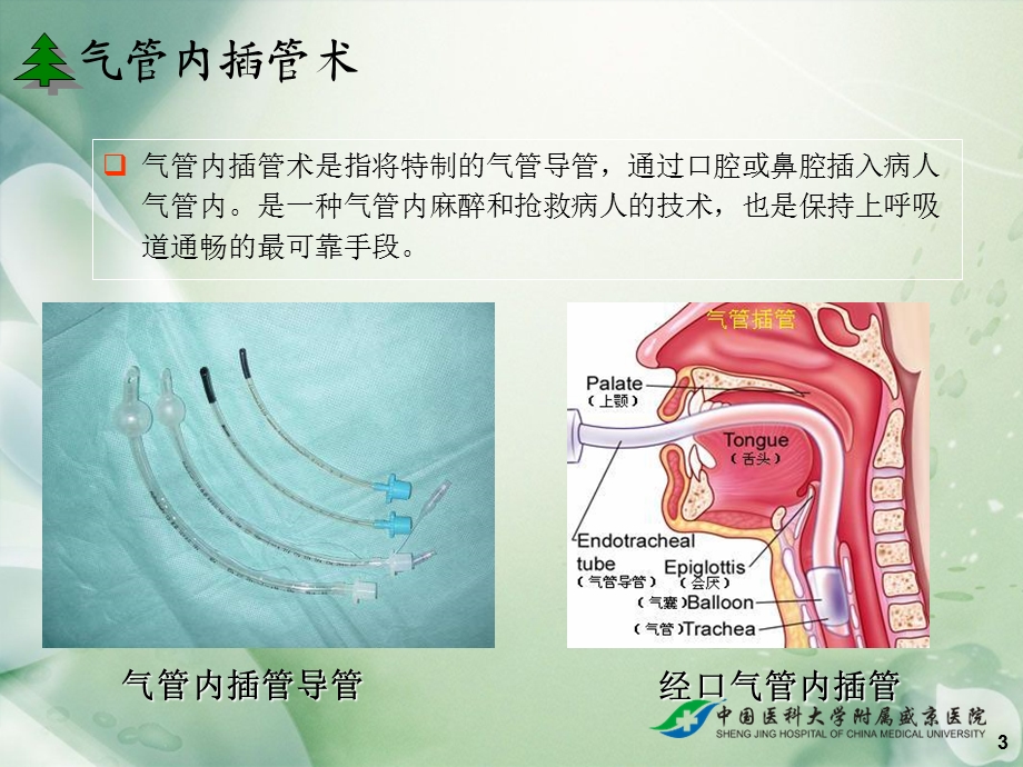 全身麻醉PPT课件.ppt_第3页