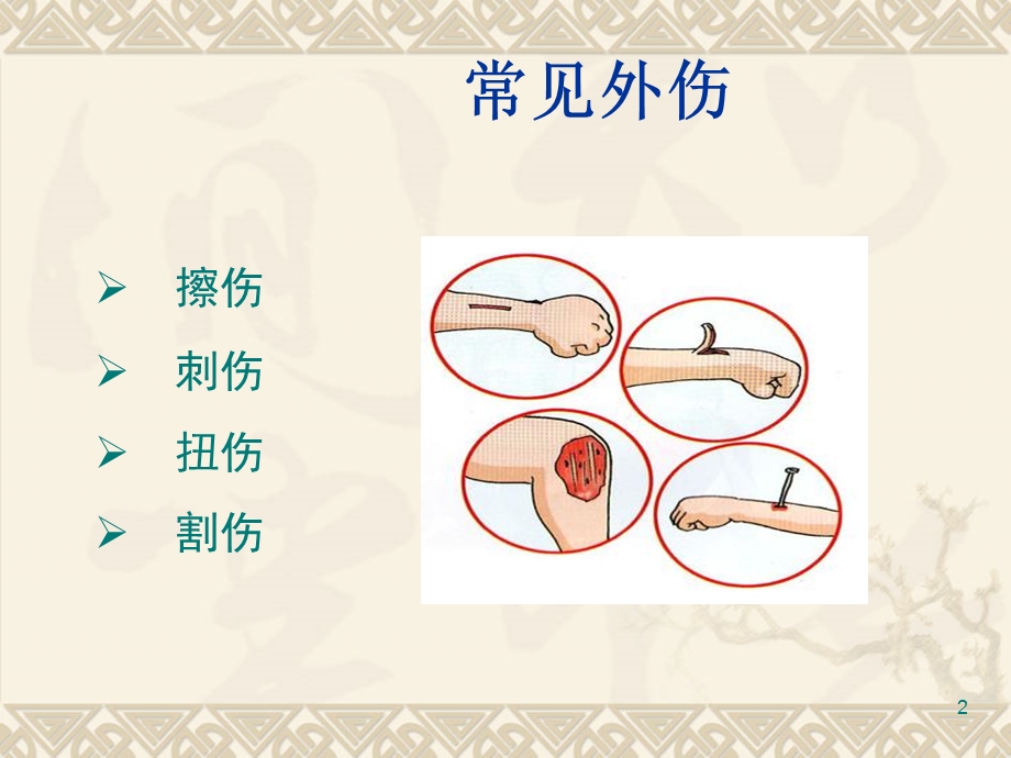 儿童常见外伤的预防及处理小学生课件.ppt_第2页