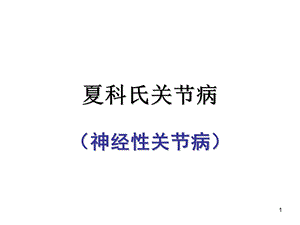 夏科氏关节病课件.ppt