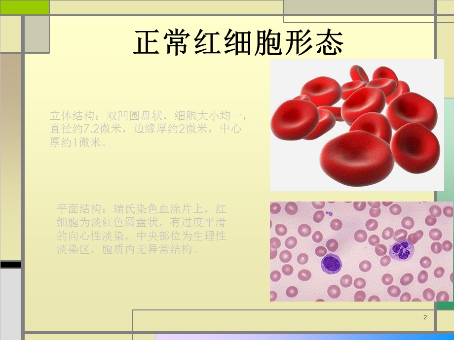 红细胞形态检查课件.ppt_第2页