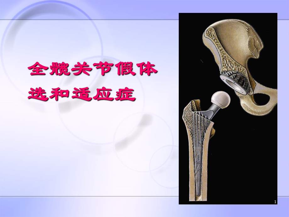 全髋关节假体选和适应症课件.ppt_第1页