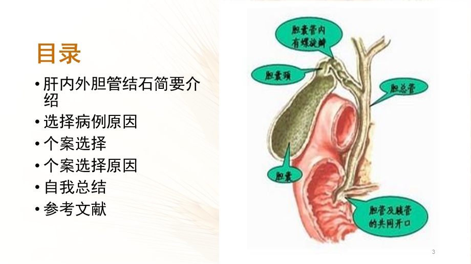 肝内外胆管结石课件.ppt_第3页