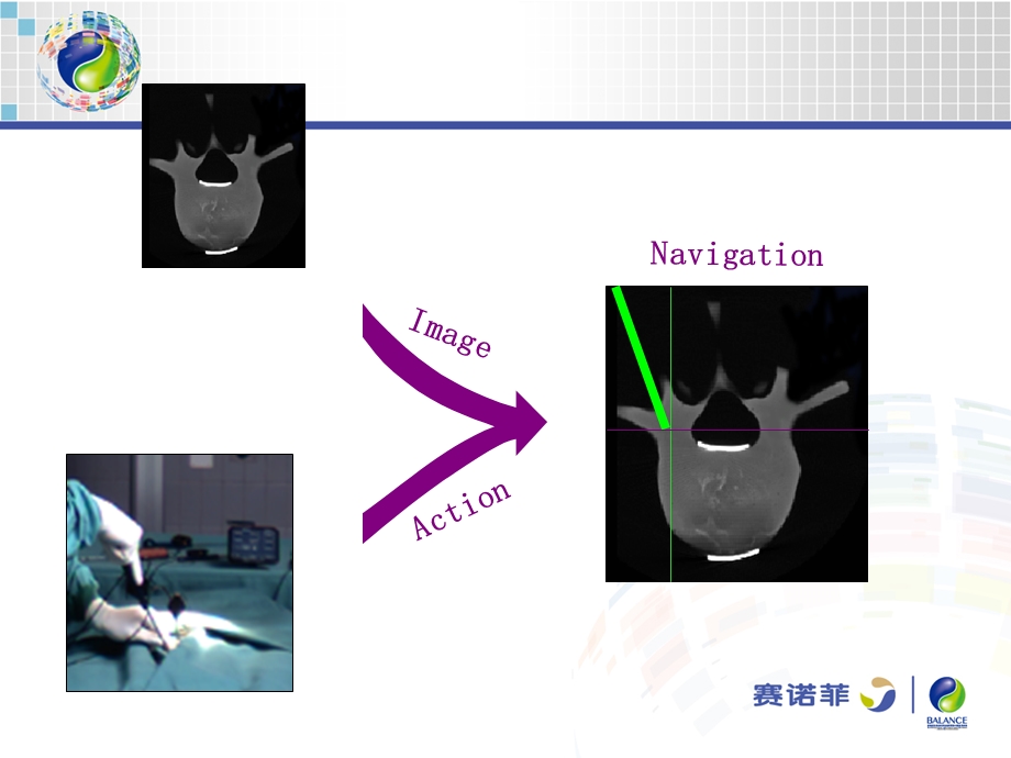 计算机导航在骨科手术中的应用课件.ppt_第3页