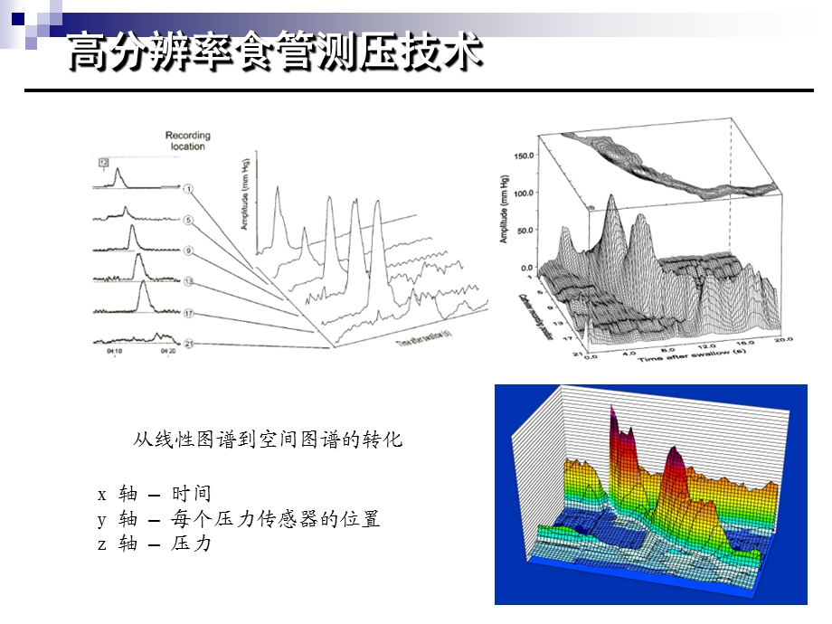 高分辨率食管测压检测技术的临床应用课件.ppt_第2页