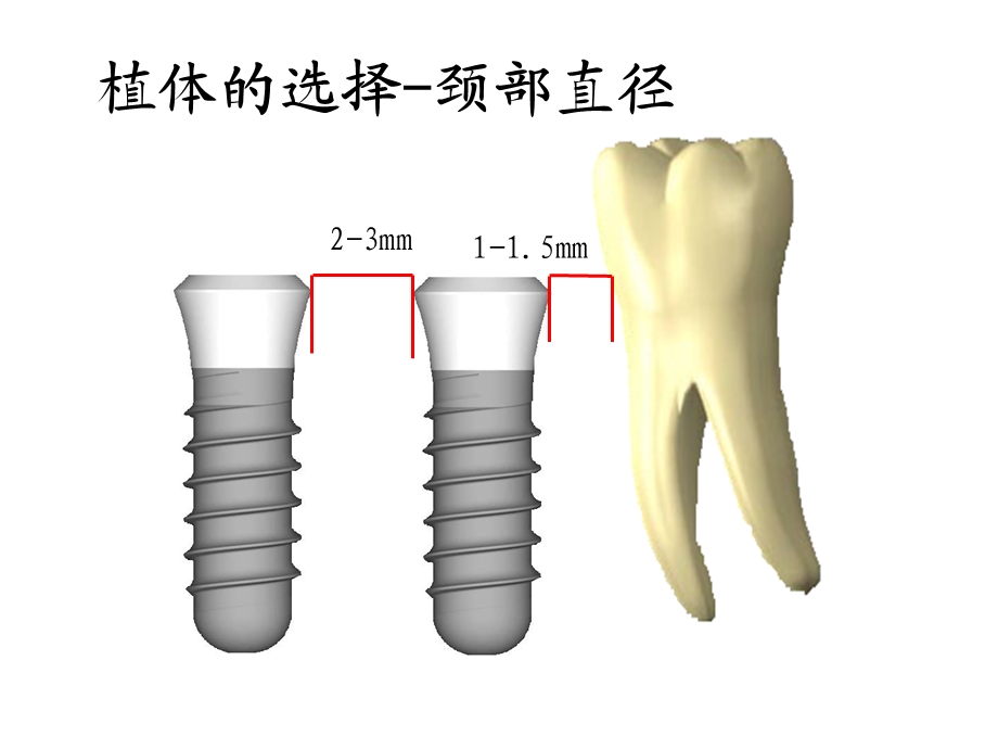 种植区骨量不足的处理课件.ppt_第3页