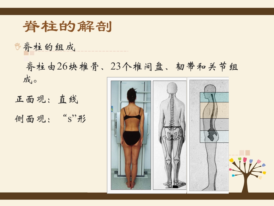 脊柱侧弯脊柱侧凸畸形护理查房课件.ppt_第2页