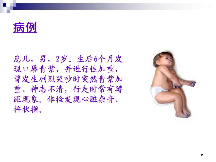 青紫型先天性心脏病课件.ppt_第2页