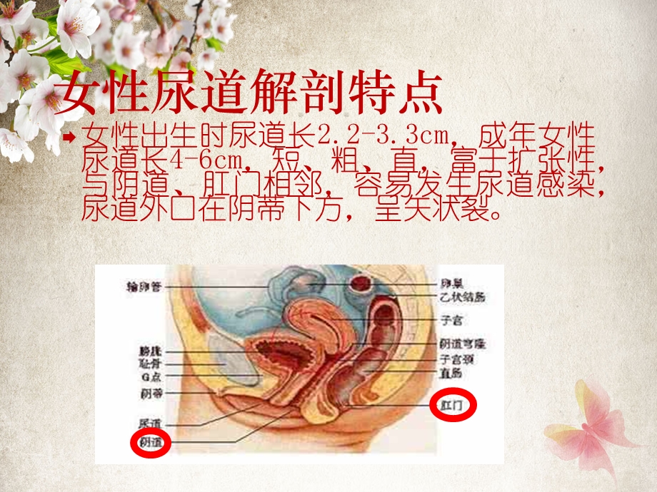 女病人导尿术课件.ppt_第3页