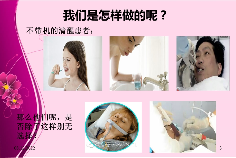 气管插管病人的口腔护理 课件.ppt_第3页