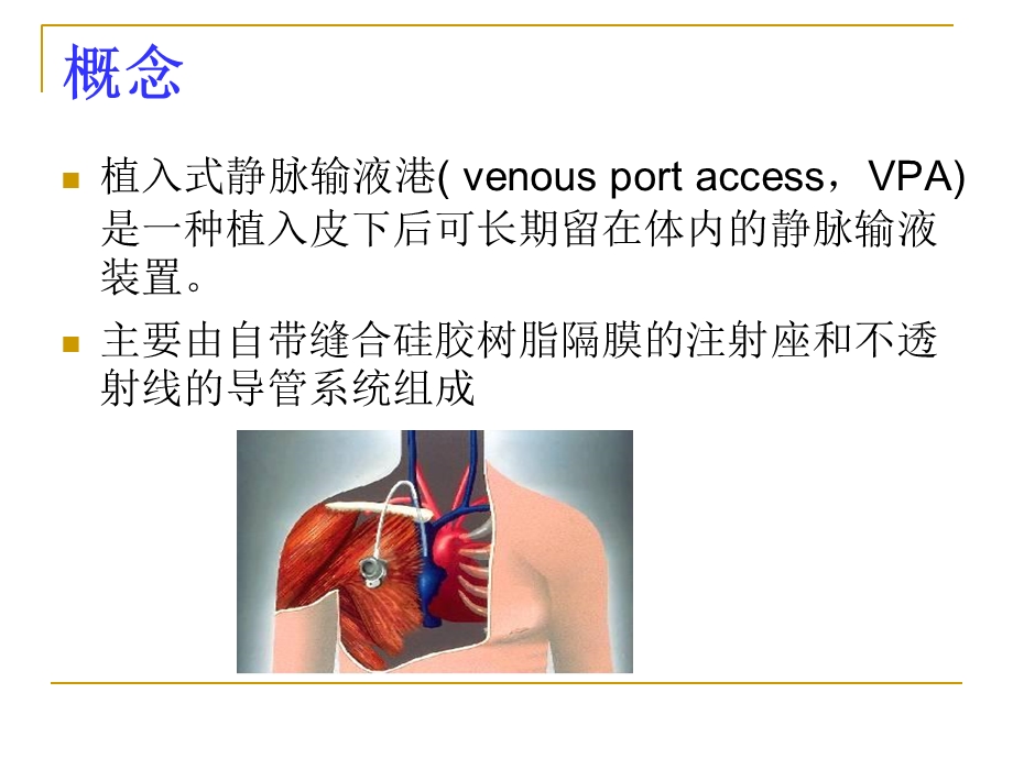 输液港护理 课件.ppt_第3页