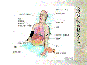 心力衰竭的护理教学查房课件.ppt