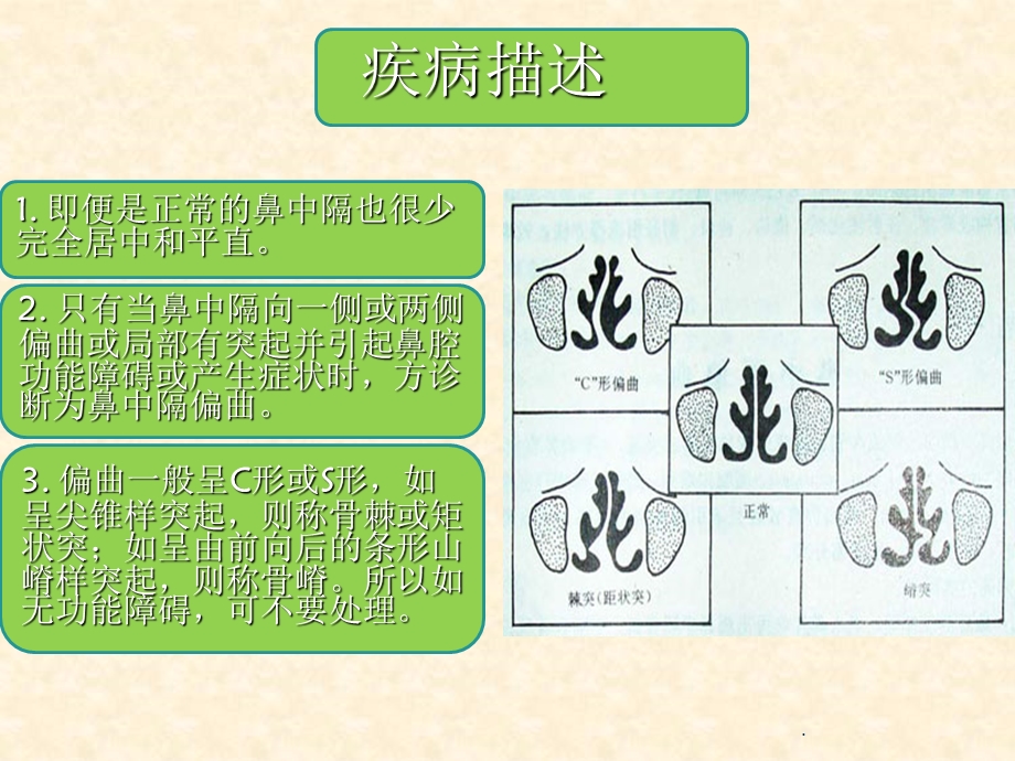 鼻中隔偏曲护理教学课件.ppt_第3页