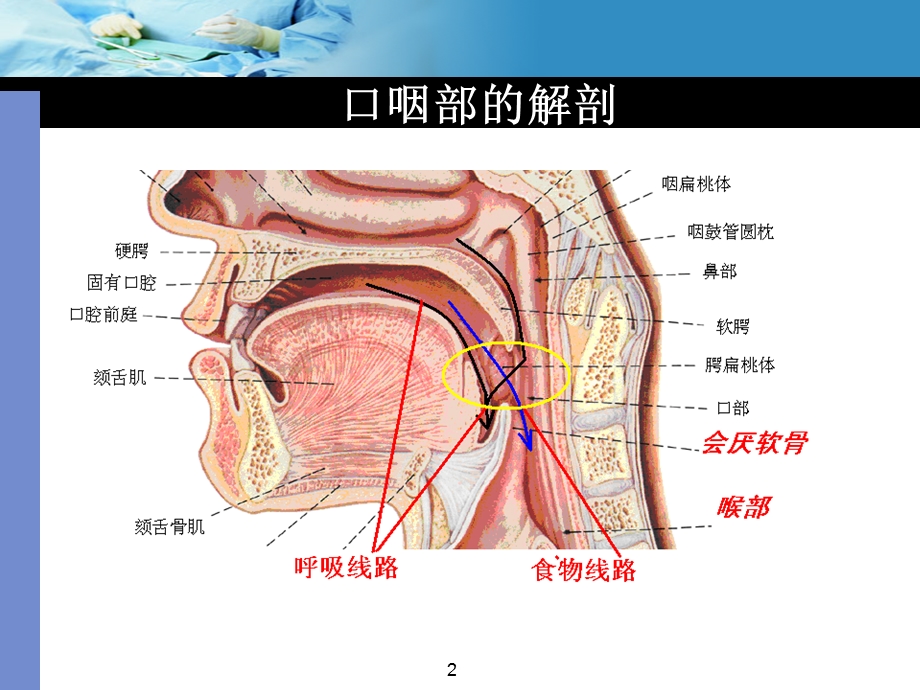 口咽通气道的使用课件.ppt_第2页