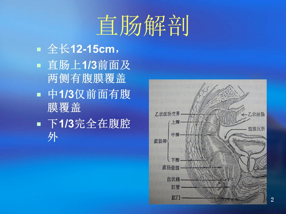 直肠癌手术配合课件.ppt_第2页