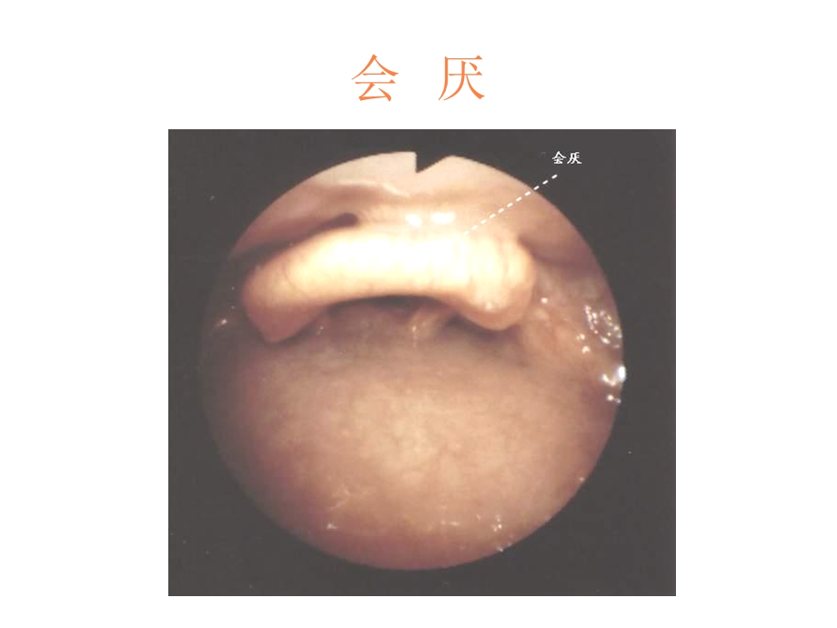 纤支镜的临床图谱课件.ppt_第1页