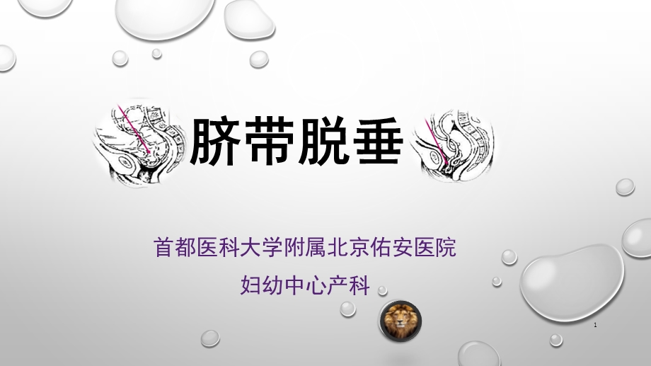 脐带脱垂课件.ppt_第1页