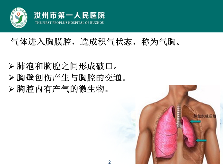 气胸健康教育课件.ppt_第2页