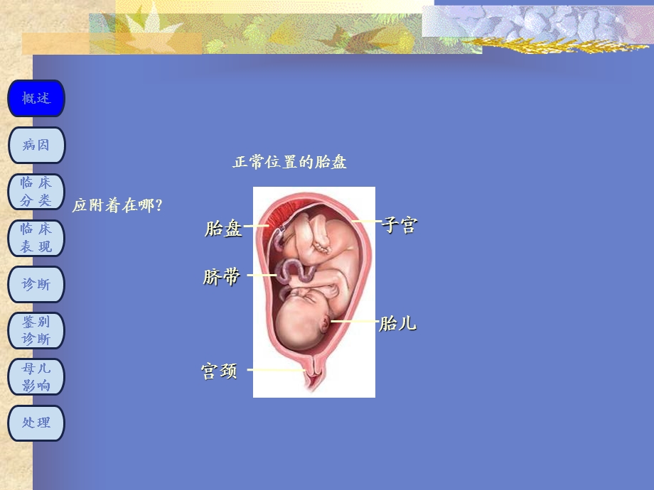 前置胎盘教学ppt课件.ppt_第3页