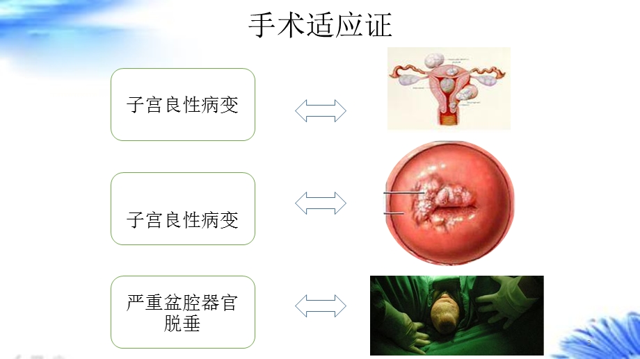 腹腔镜下全子宫切除骶前固定手术配合课件.ppt_第3页