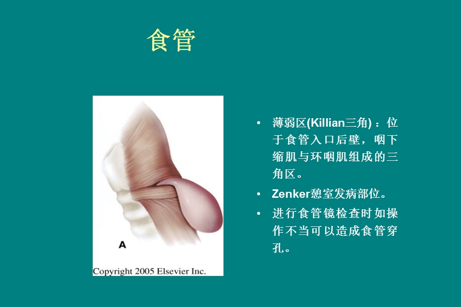 食管异物护理课件.ppt_第3页