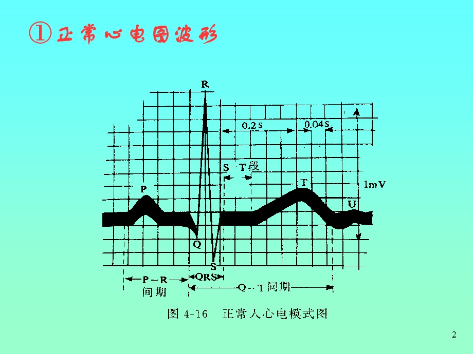 钾对心电图的影响课件.ppt_第2页