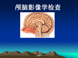 颅脑影像学检查课件.ppt