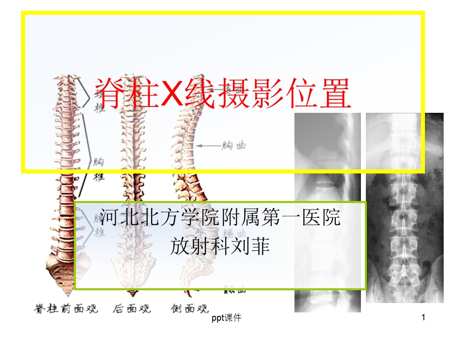 脊柱X线摄影技术课件PPT.ppt_第1页