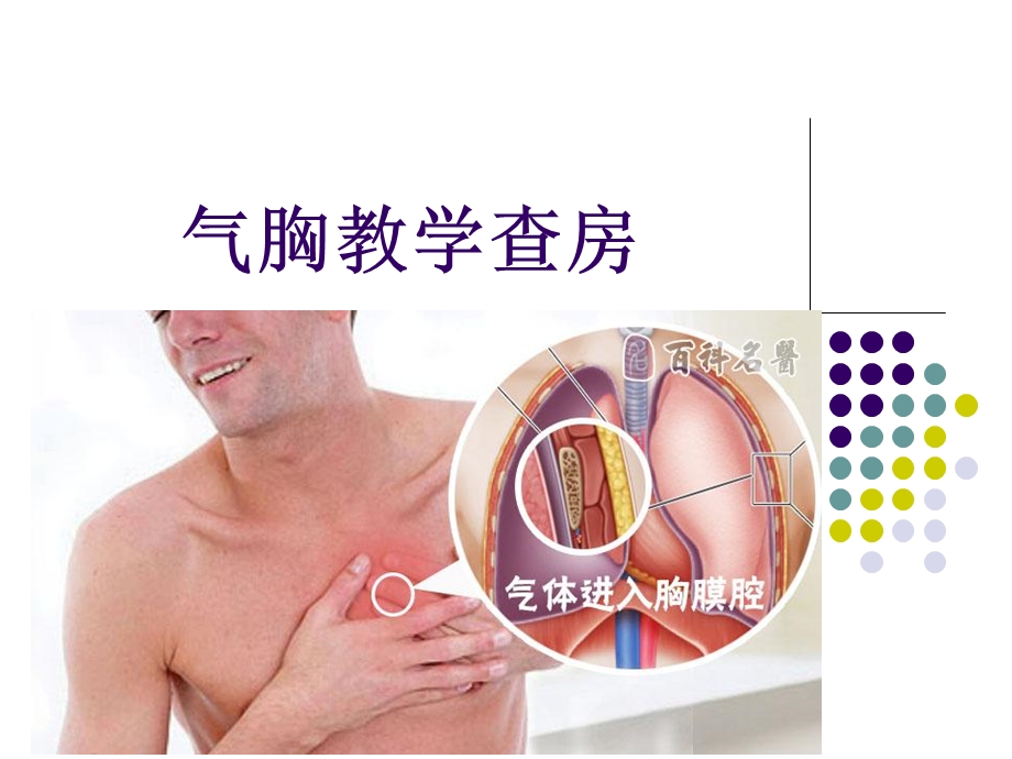 气胸教学查房ppt课件.ppt_第1页