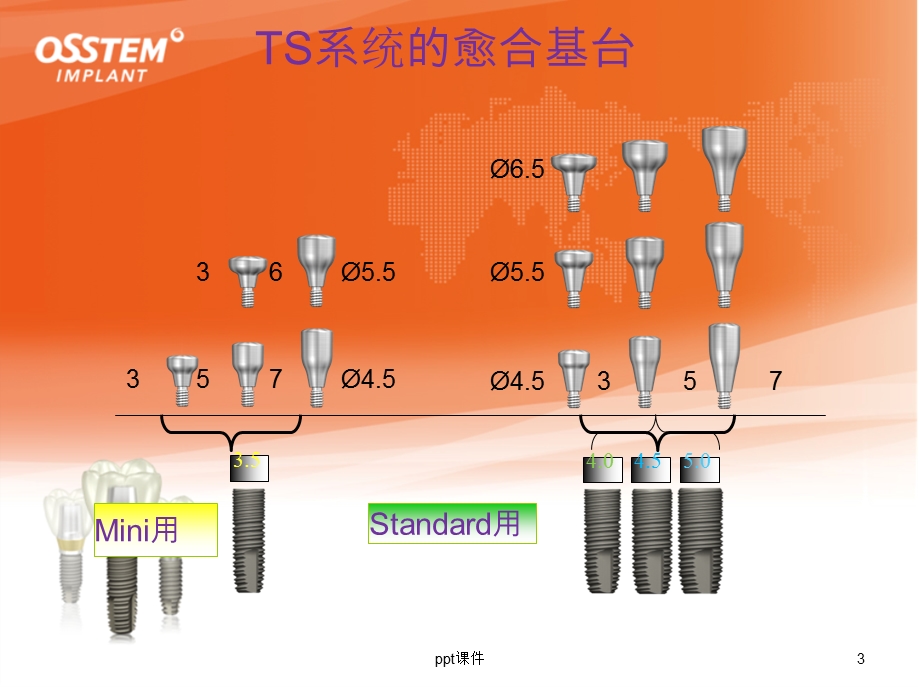 奥齿泰修复取模课件.ppt_第3页