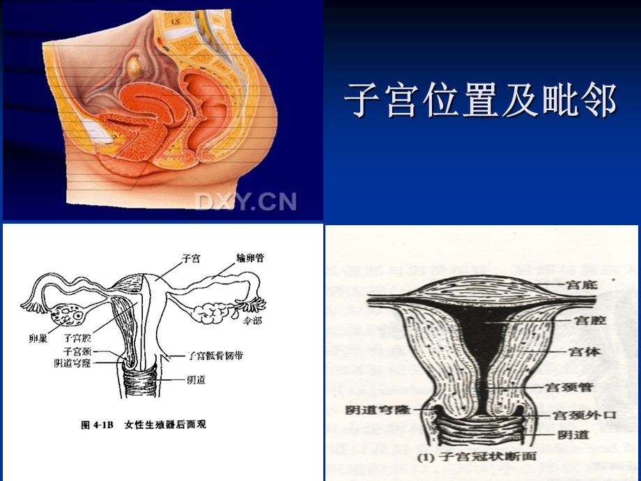 妇科常见疾病的超声检查课件.ppt_第2页